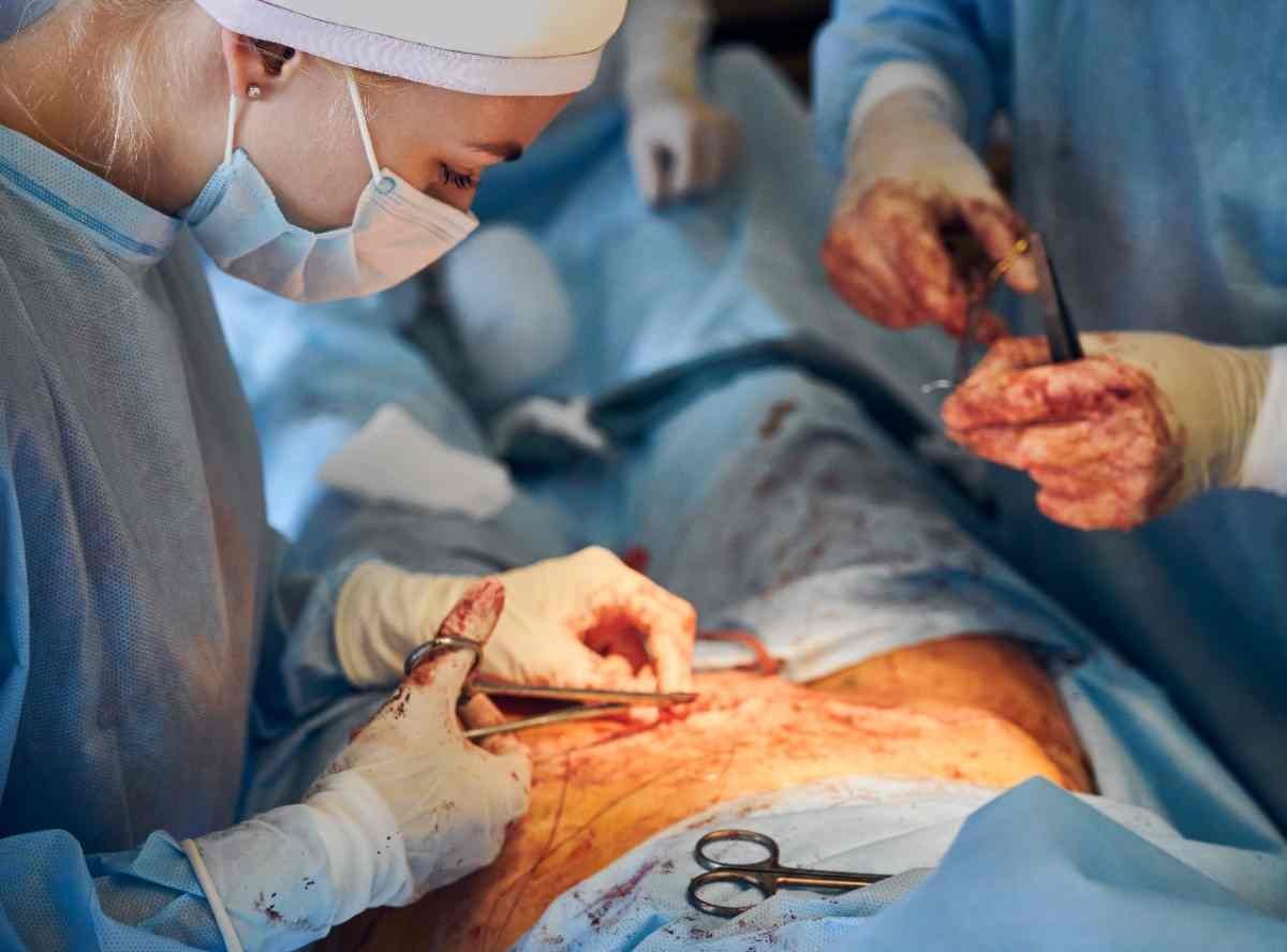 Cesarean Section (C-Section)